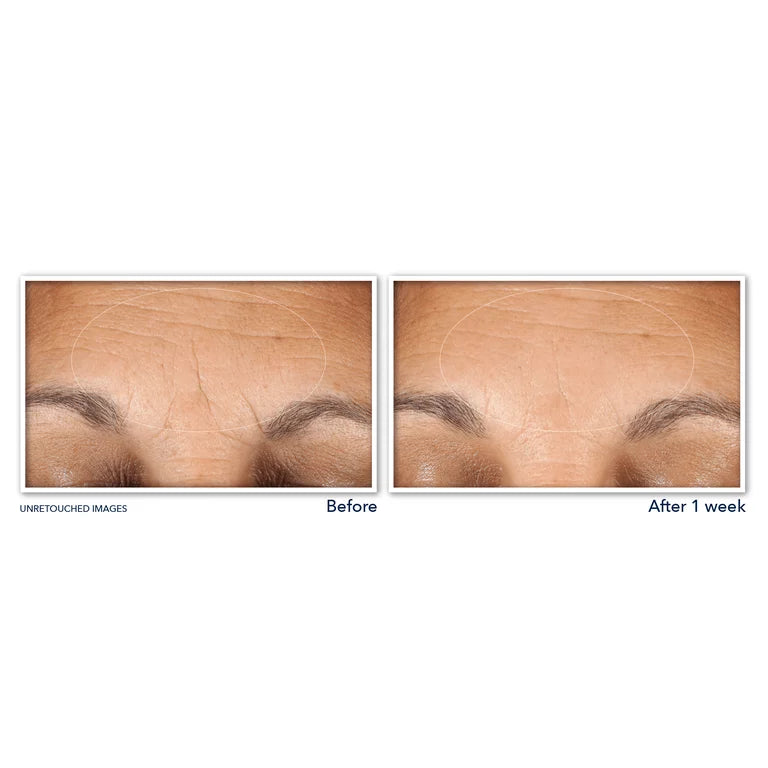 RoC Multi Correxion® Hydrate + Plump Eye Cream