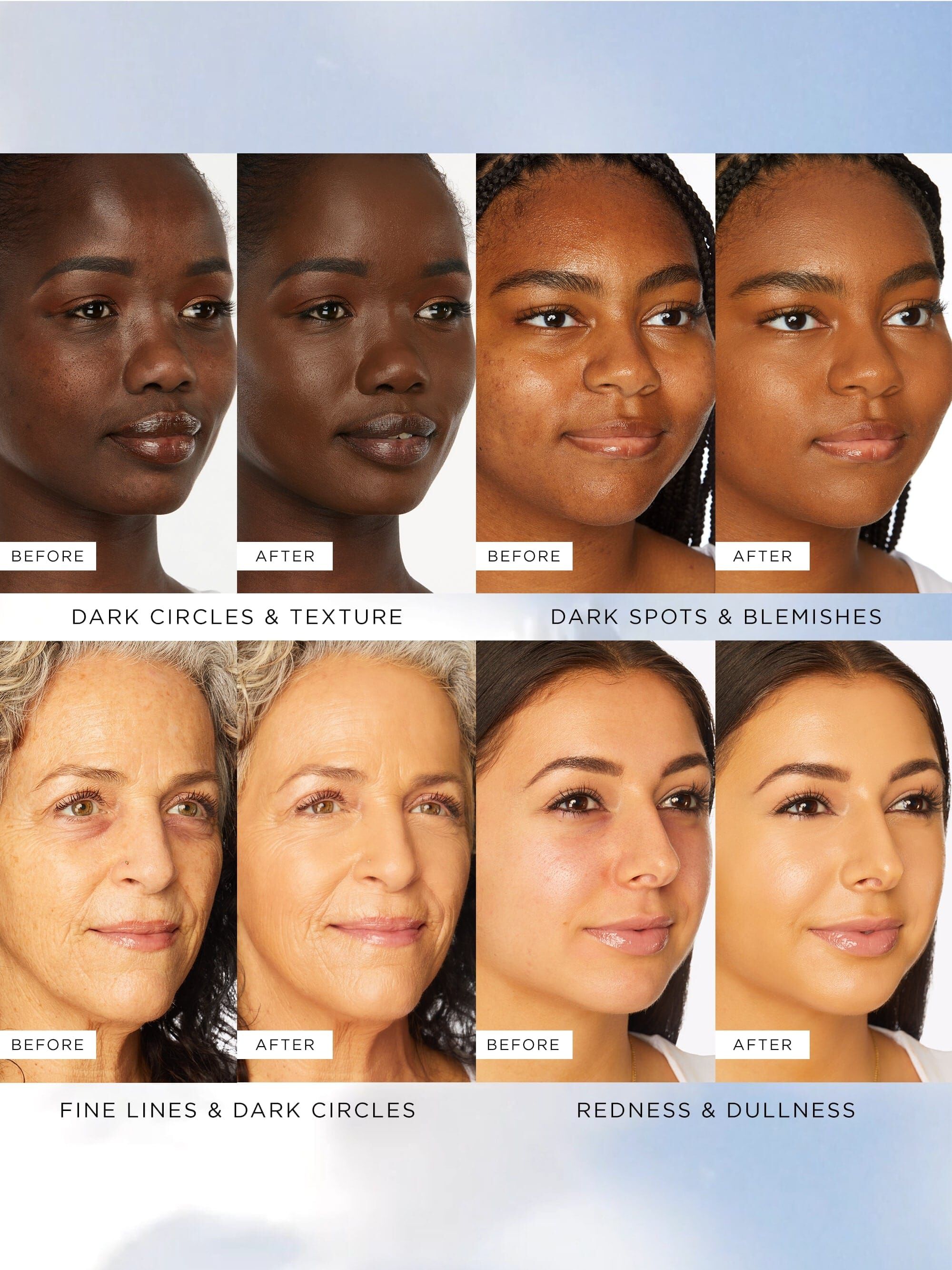 Tarte Shape Tape™ Radiant Medium Coverage Concealer