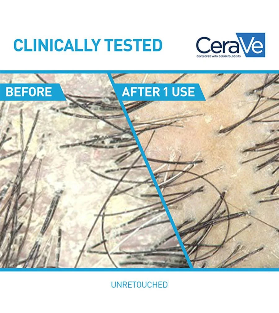CeraVe 2-in-1 Anti-Dandruff Hydrating Shampoo and Conditioner