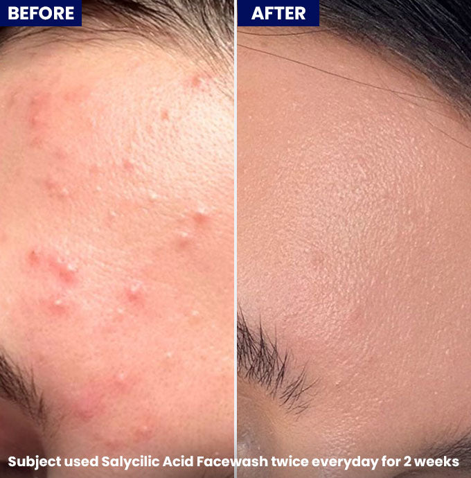 Jenpharm Salicylic Acid Face Wash