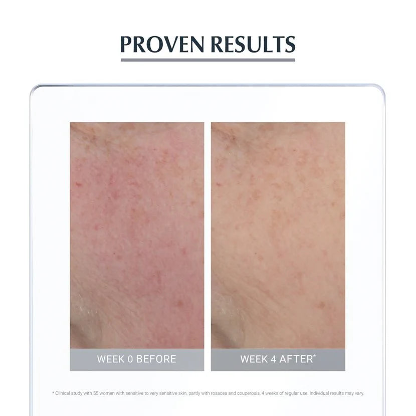 Eucerin Anti-Redness Concealing Day Care Tinted SPF 25