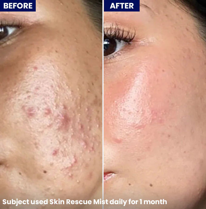 Jenpharm Skin Rescue Mist