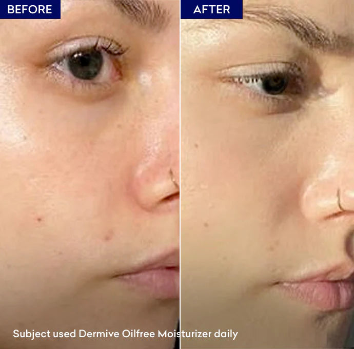 Jenpharm Dermive Oil Free Moisturizer