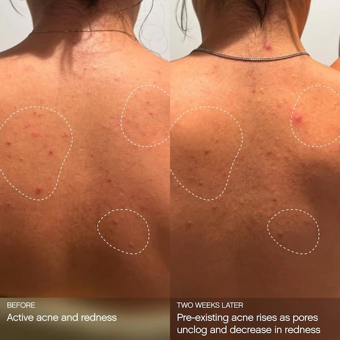 Topicals Clearly Clarifying & Calming Mist