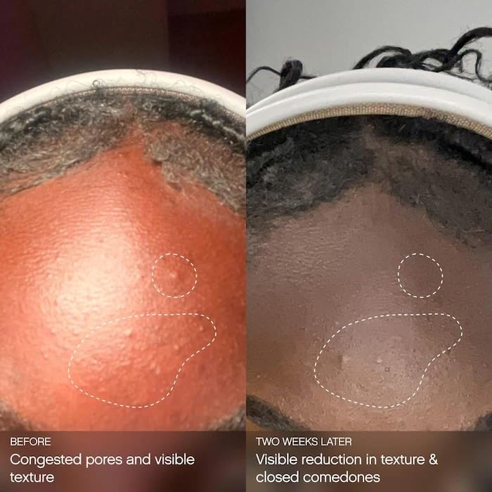 Topicals Clearly Clarifying & Calming Mist