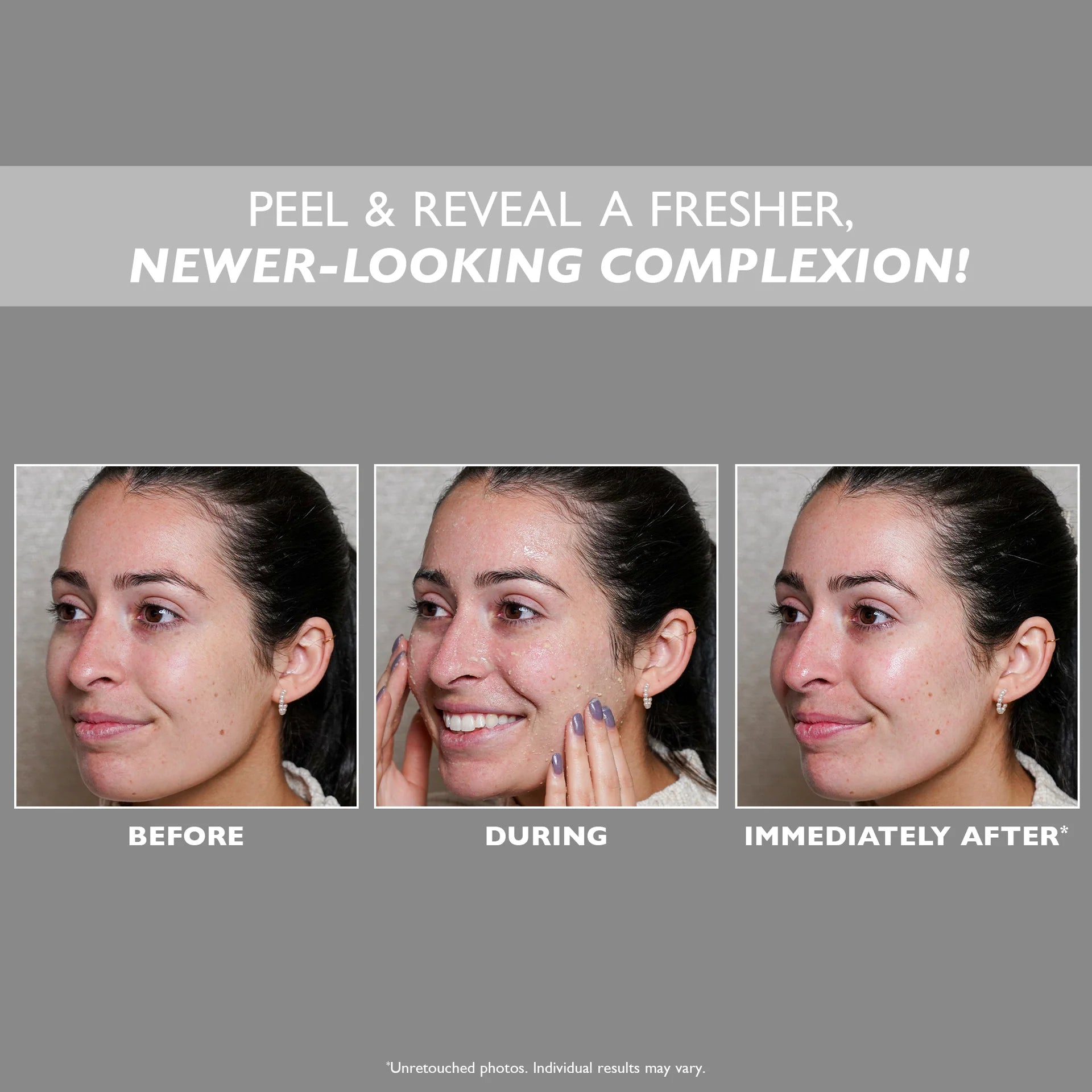 Peter Thomas Roth Firmx Peeling Gel