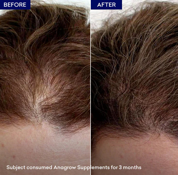 Jenpharm Anagrow Soft Gel Capsules