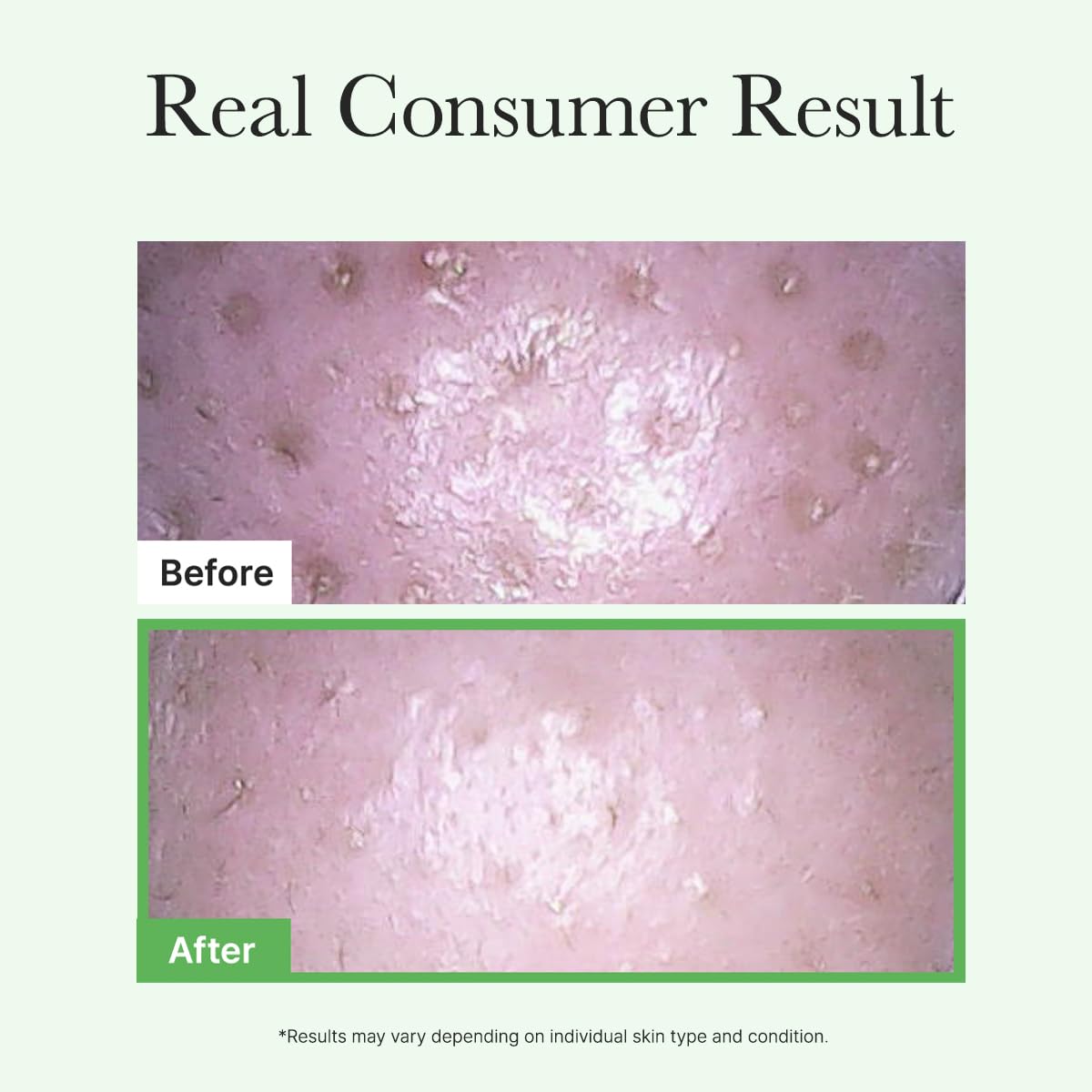 Arencia Pore Mochi Makeup Removing Cleansing Oil