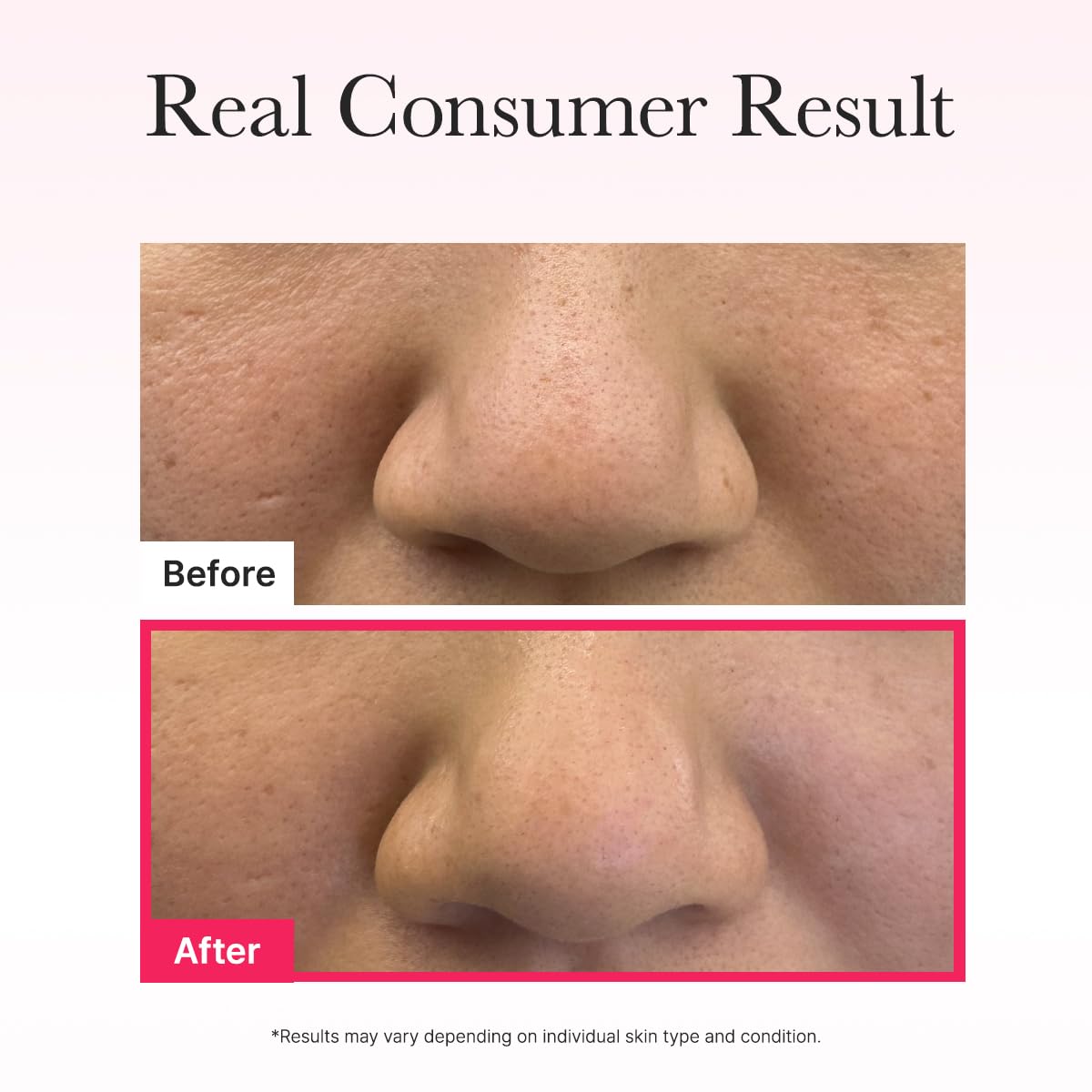 Arencia Red Collagen Tensioning Sheet Mask