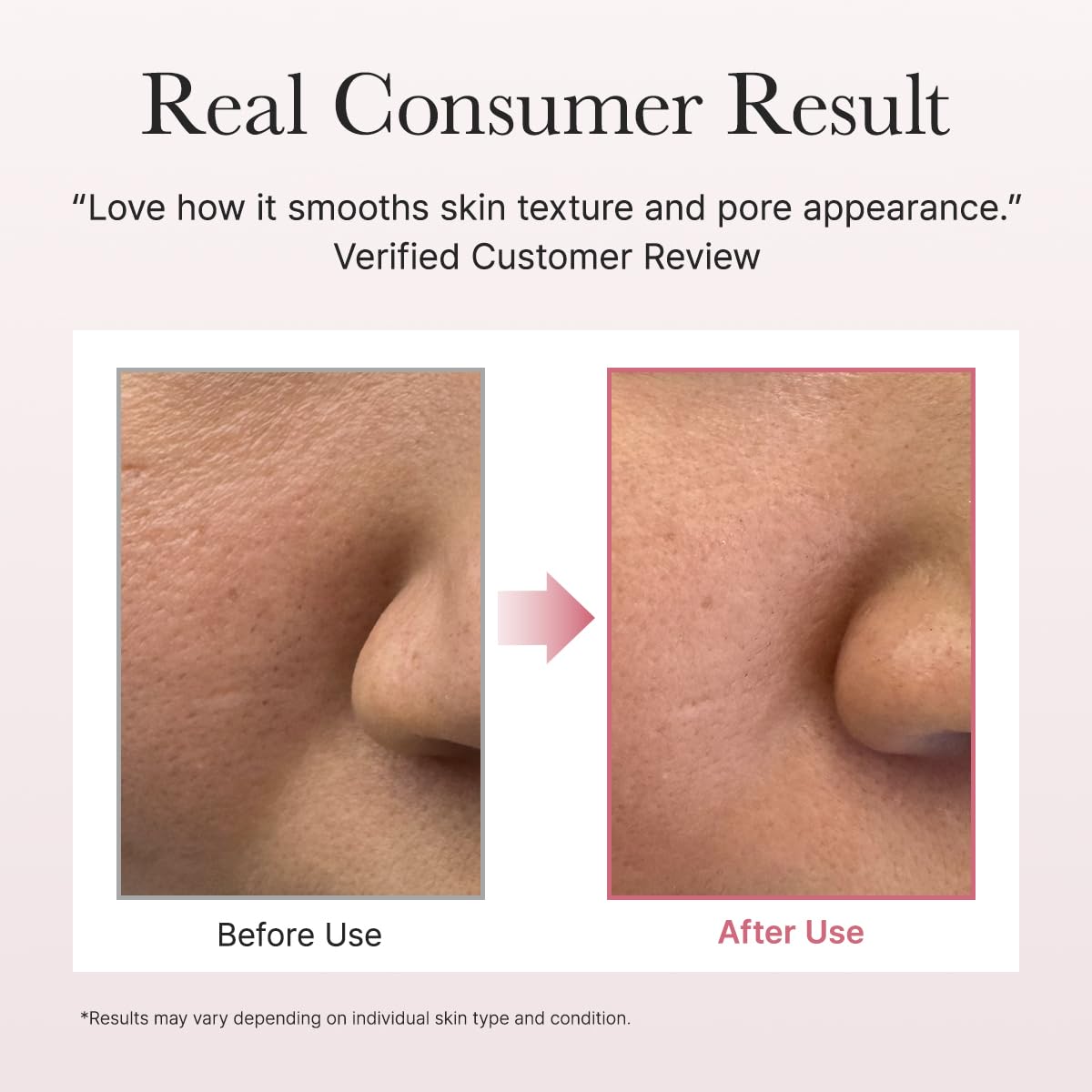 Arencia Red Smoothie Lotion 5 Niacinamide & Collagen