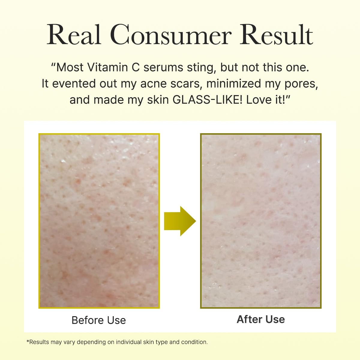Arencia Vitamin C Booster Shot Face & Eye Moisturizer