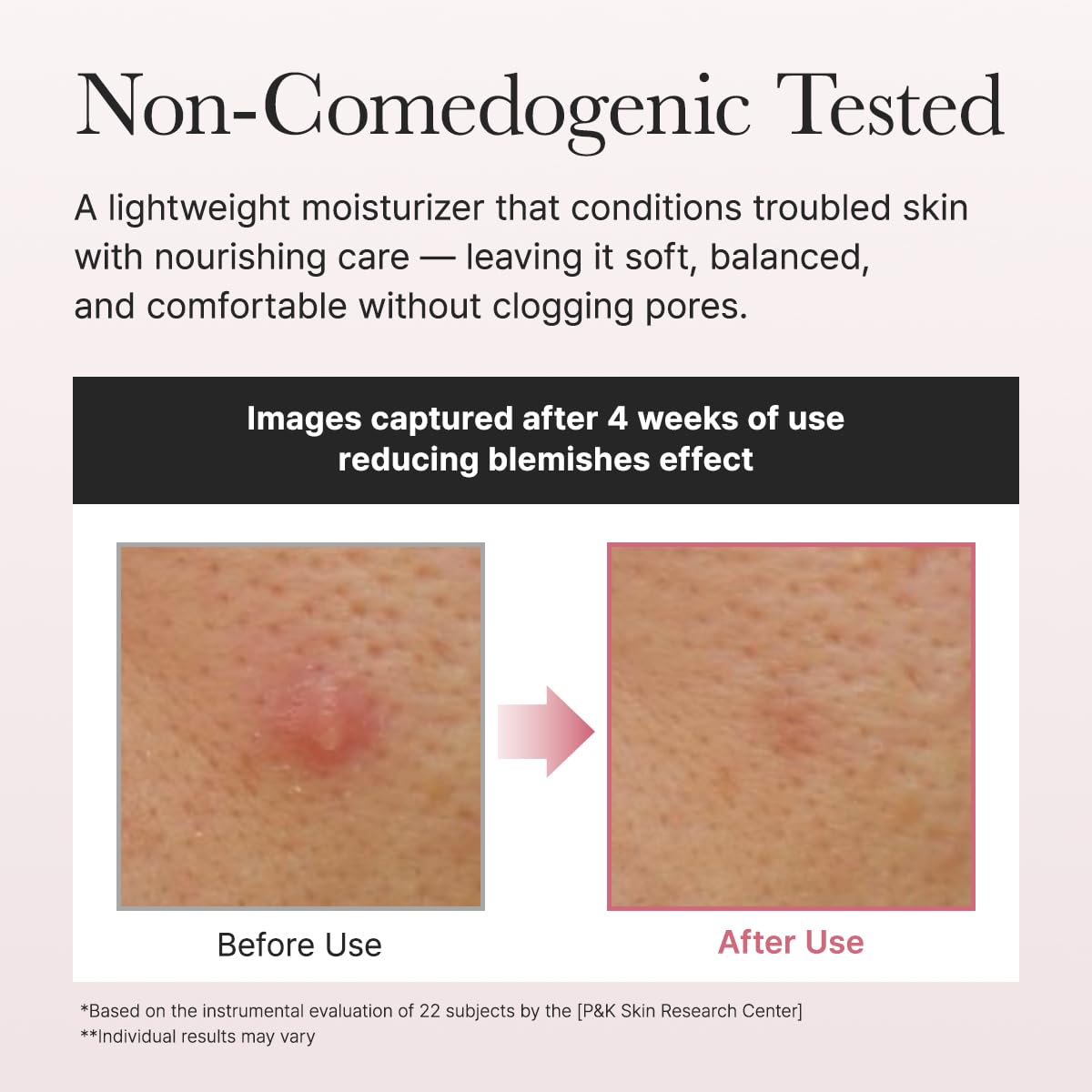 Arencia Red Smoothie Lotion 5 Niacinamide & Collagen