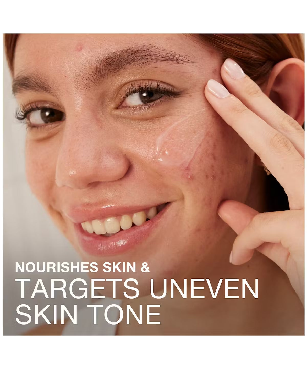 Neutrogena Ultra Gentle Face Gel Hydrator for Acne-Prone Skin