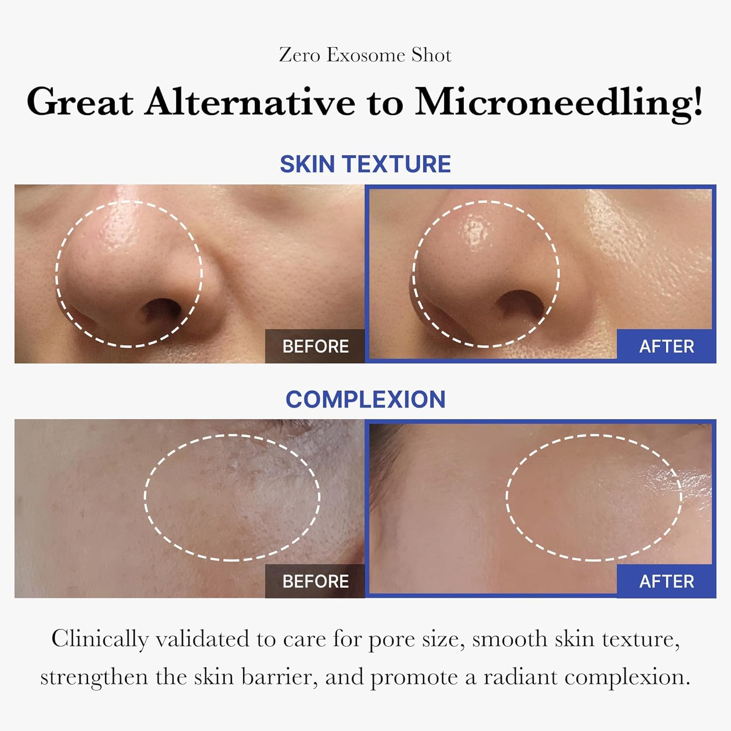 Medicube One Day Exosome Shot 2000