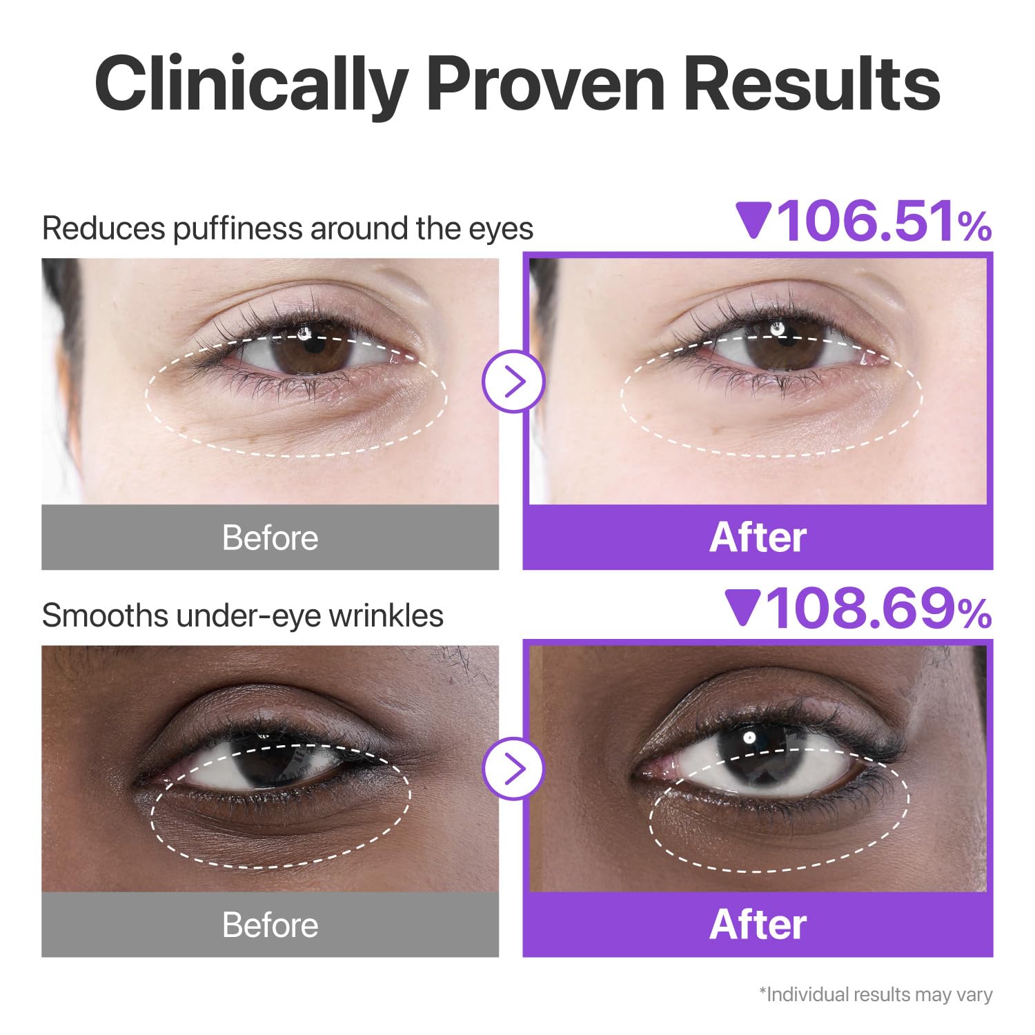 Numbuzin No. 9 NAD+ Collagen Under Eye Patches