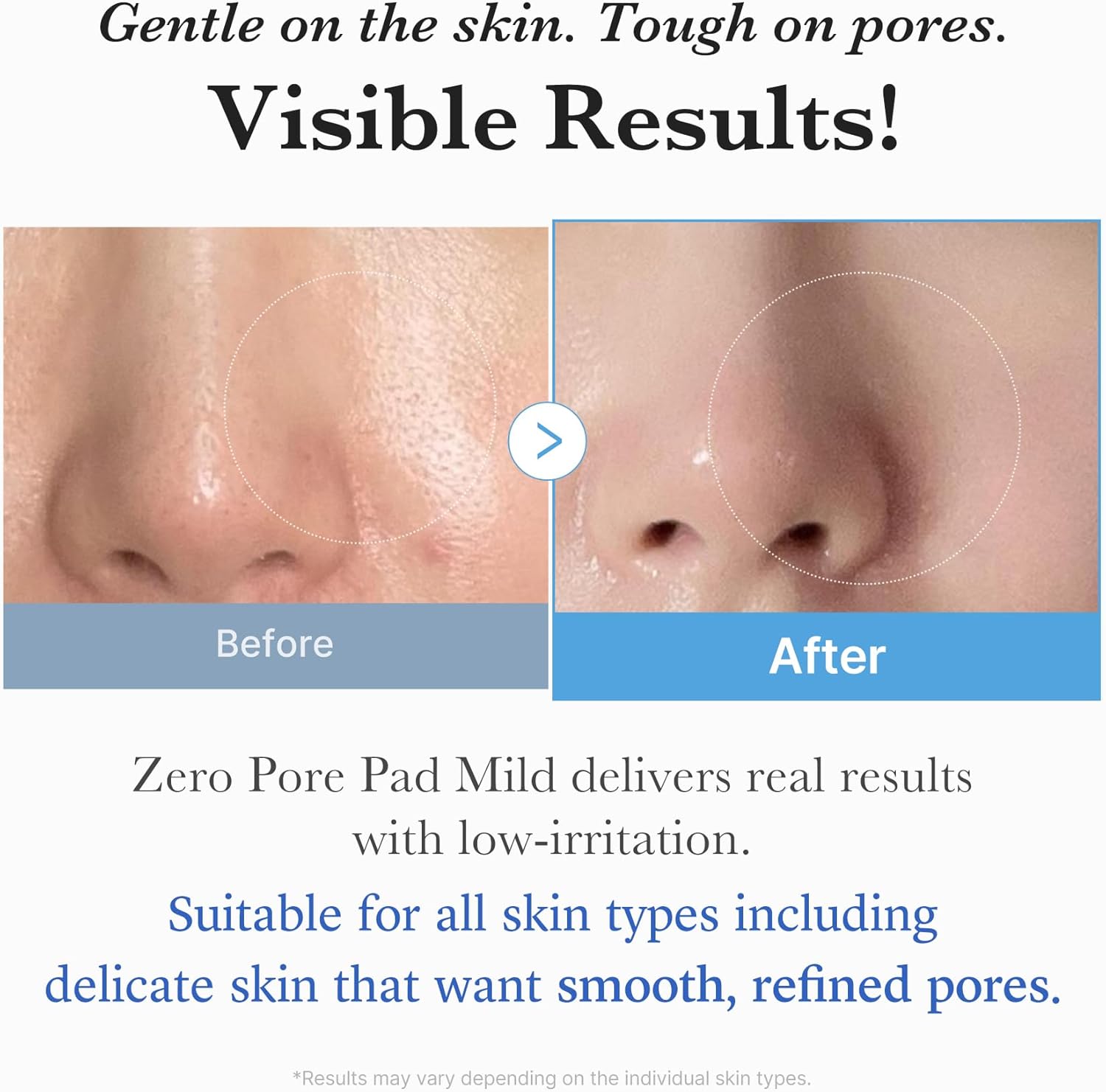 Medicube Zero Pore Pad Mild