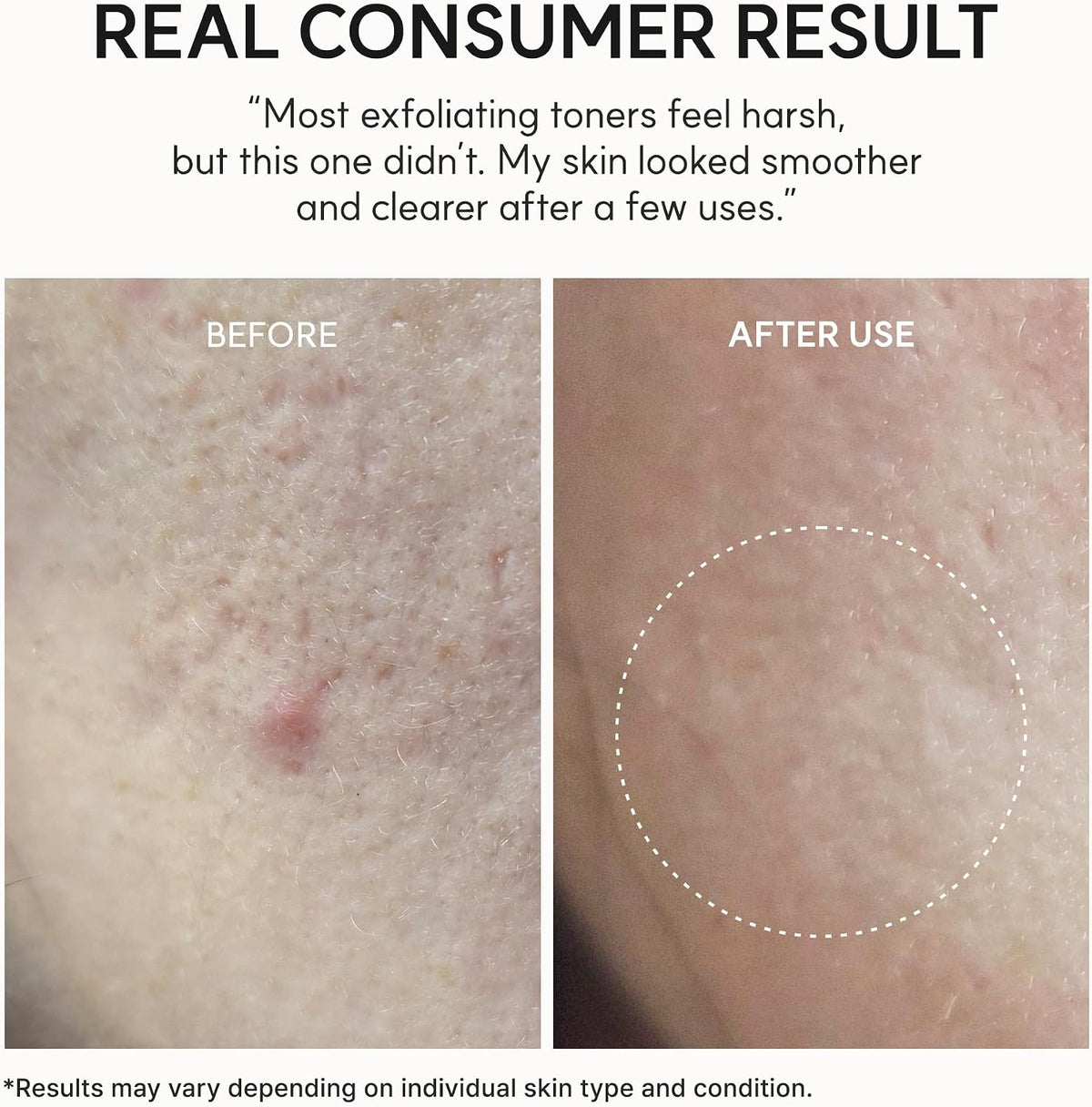 Arencia Eraser Shot Glycolic Acid Exfoliator
