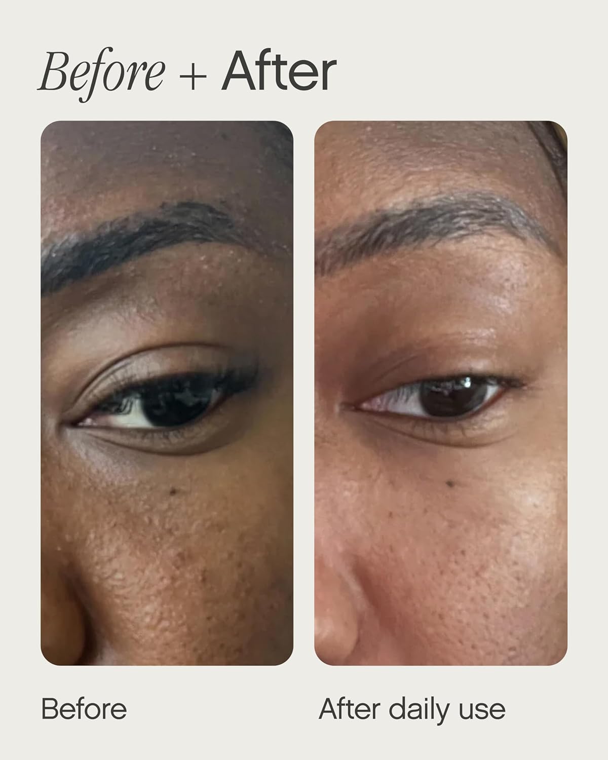 Topicals Sealed Active Scar Primer