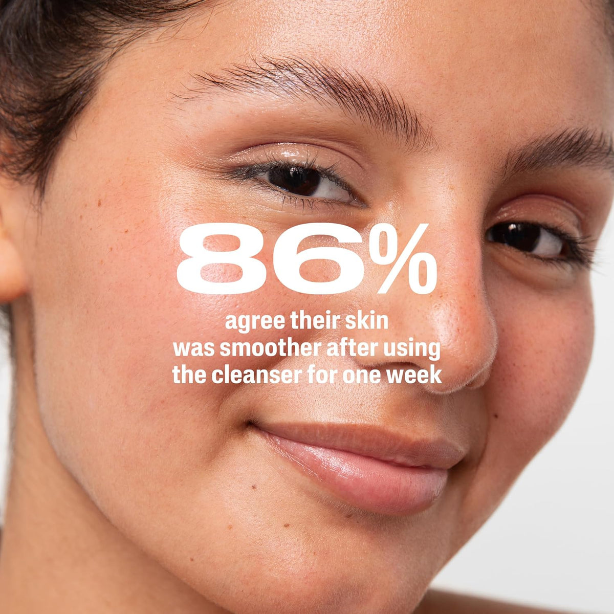 Cetaphil Acne Gentle Clear Complexion Clearing Acne Cleanser