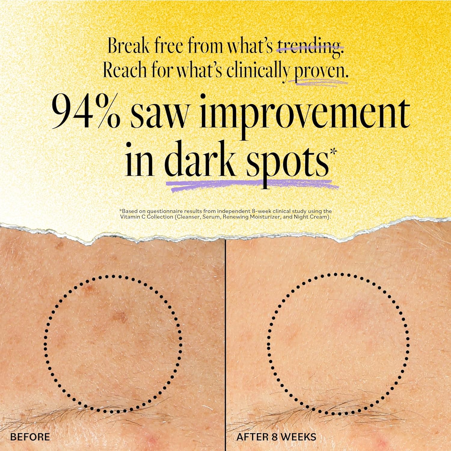 Derma E Vitamin C Renewing Moisturizer