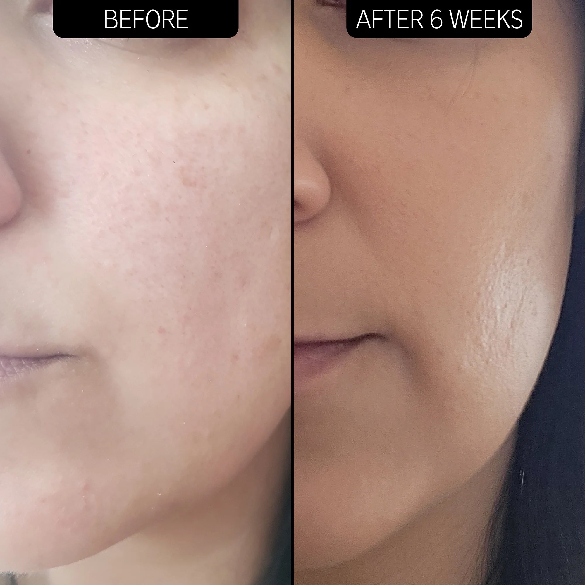 The Inkey List Dry and Rough Skin Solution with 10% Urea Moisturizer