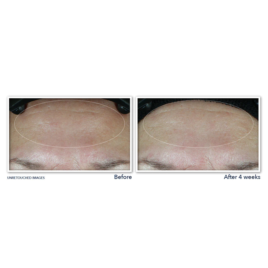 RoC Multi Correxion® Hydrate + Plump Moisturizer with SPF 30