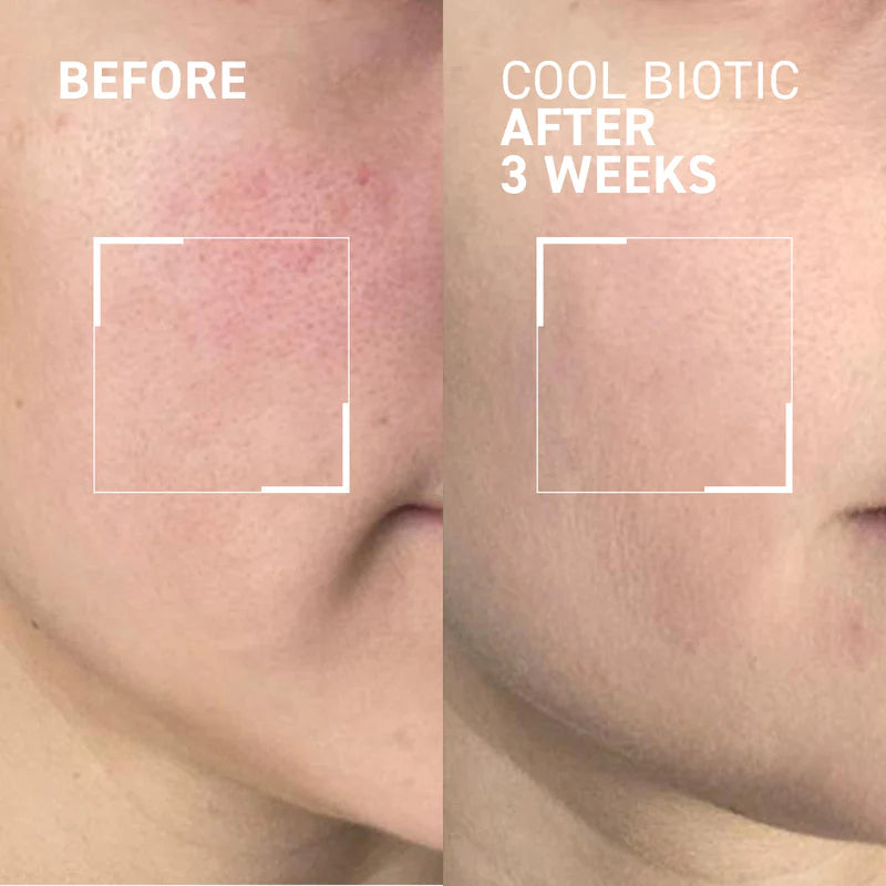 Dr. Brandt Cool Biotic Prebiotic Redness Relief Cream