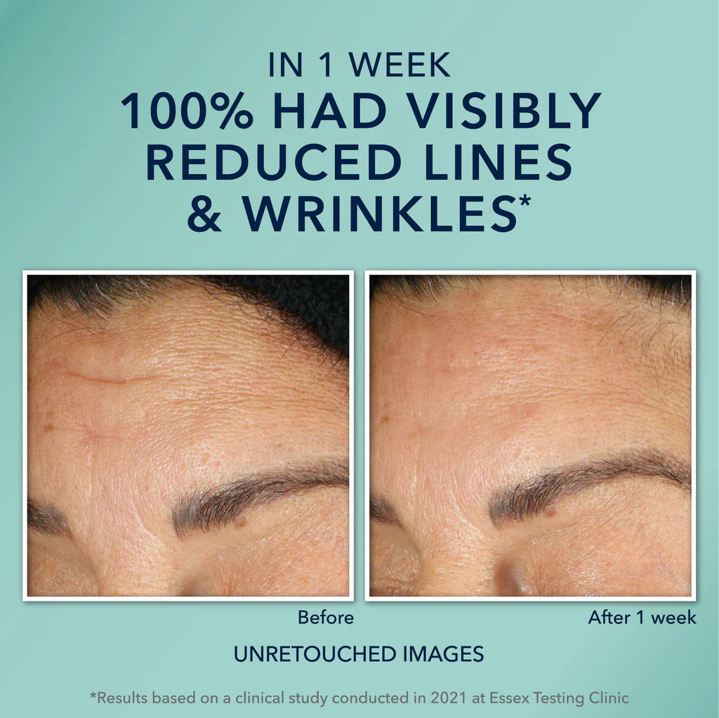 RoC Multi Correxion® Hydrate + Plump Serum Capsules