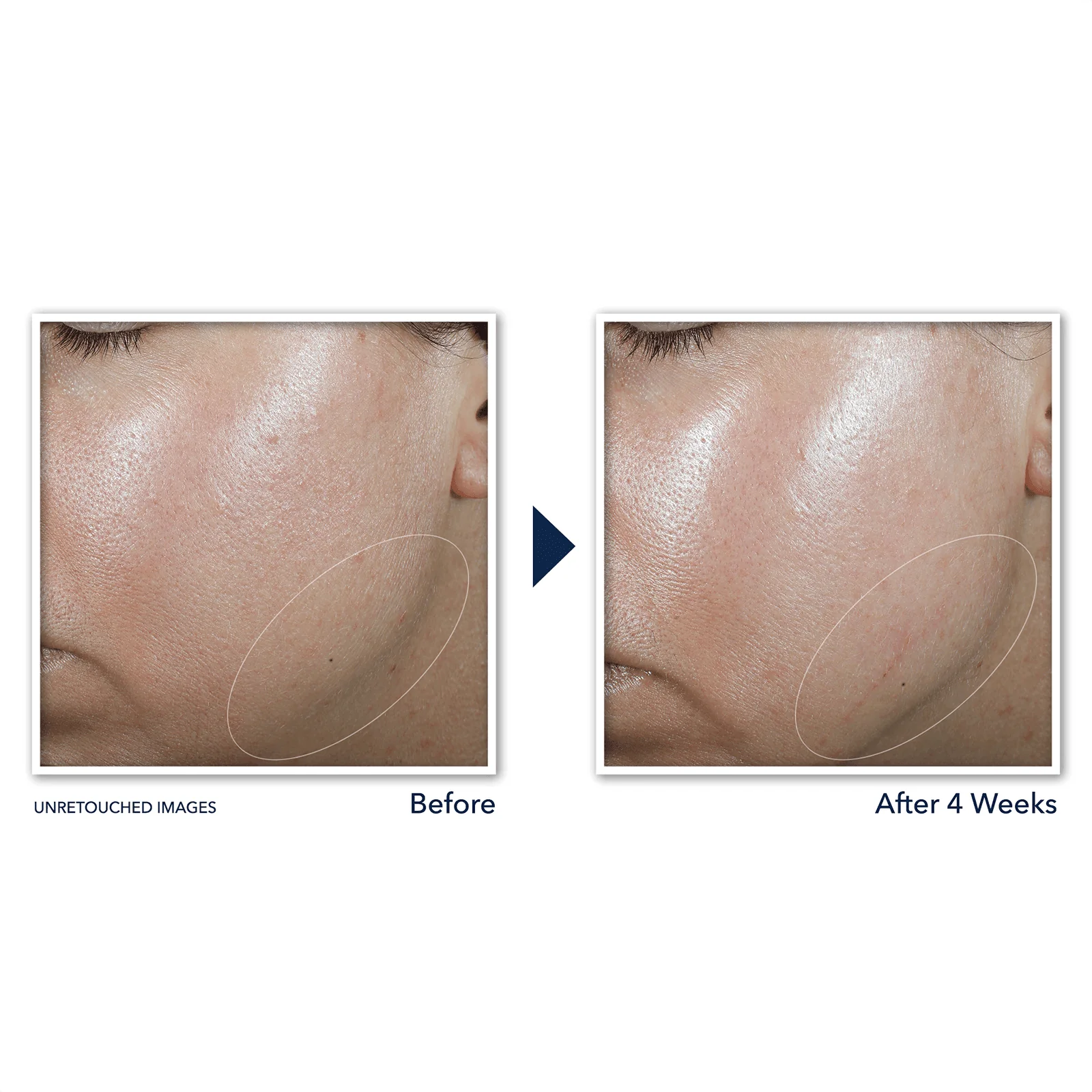 RoC® Derm Correxion® Contour Cream Advanced Retinol