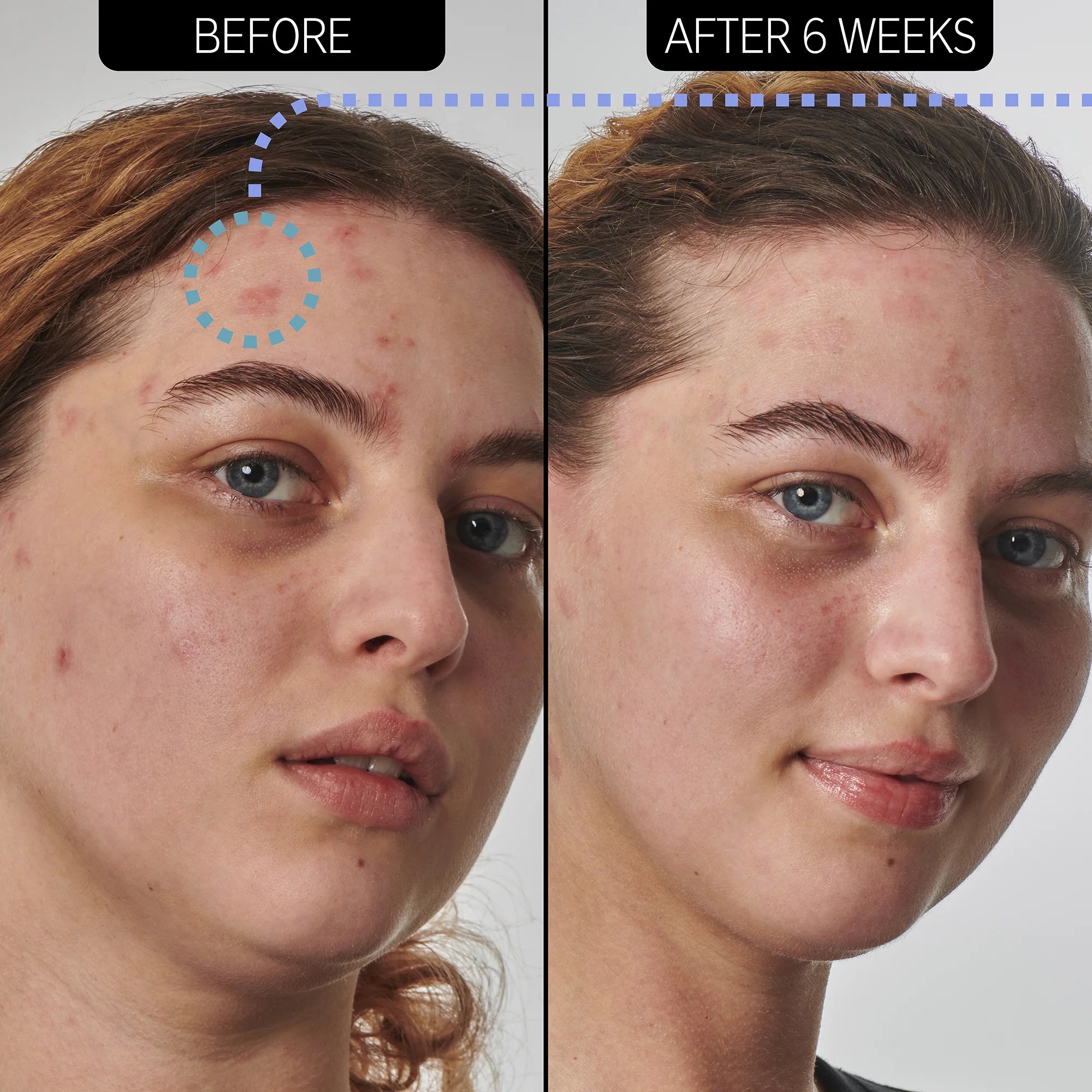 The Inkey List Dry and Rough Skin Solution with 10% Urea Moisturizer