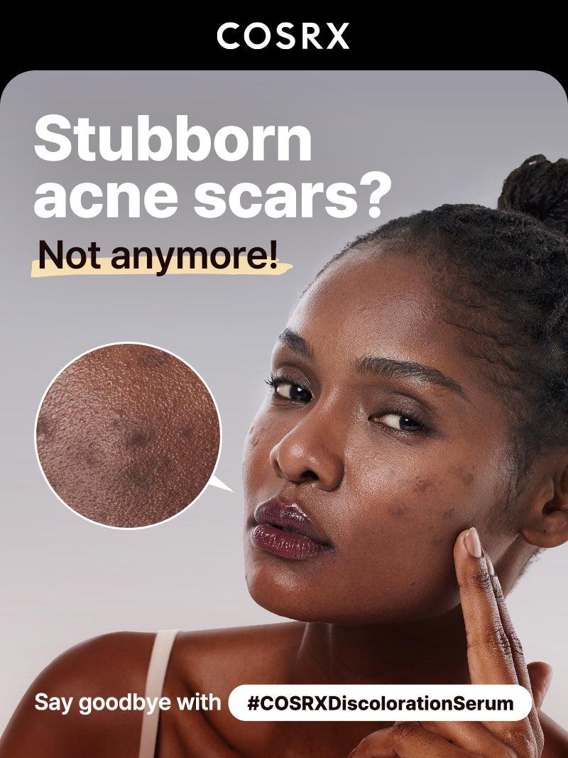 Cosrx The Alpha-Arbutin 2 Discoloration Care Serum