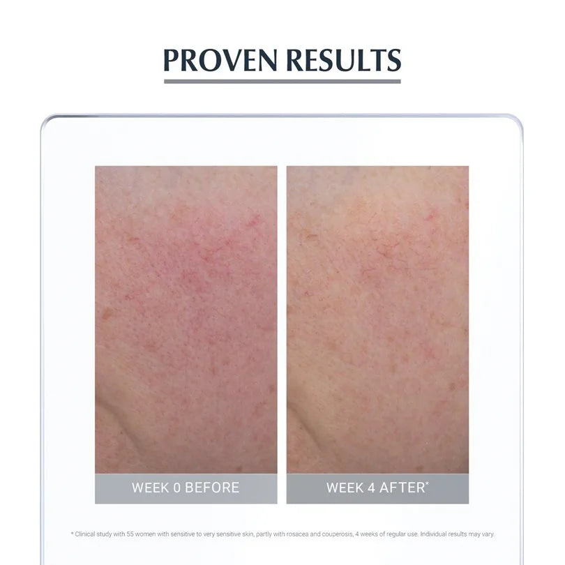 Eucerin Anti Redness Soothing Care