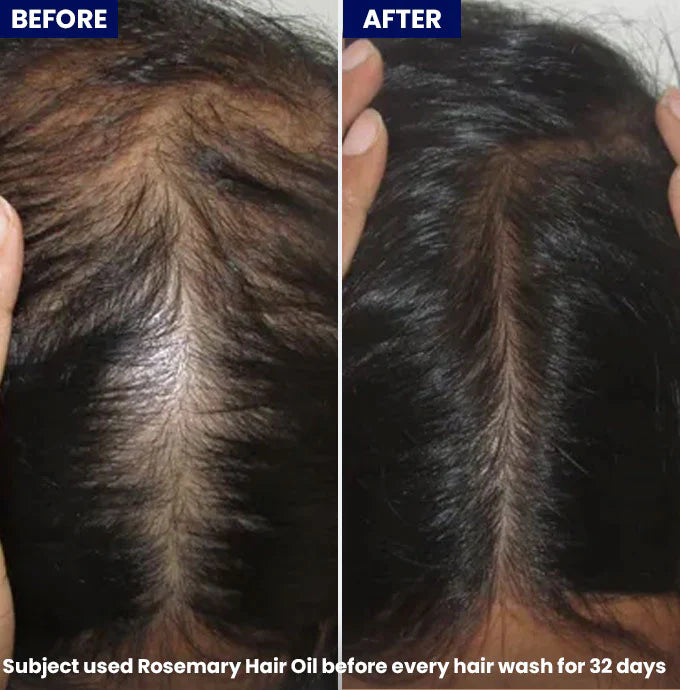 Jenpharm Anagrow Rosemary Hair Growth Oil