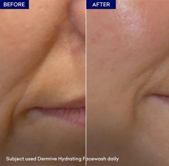 Jenpharm Dermive Moisturizing Face Wash