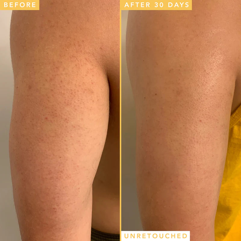 Farmacy Honeymoon Glow Body 12% AHA/BHA Resurfacing Serum