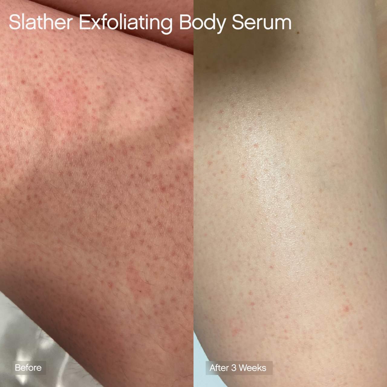 Topicals Slather Exfoliating Body Serum