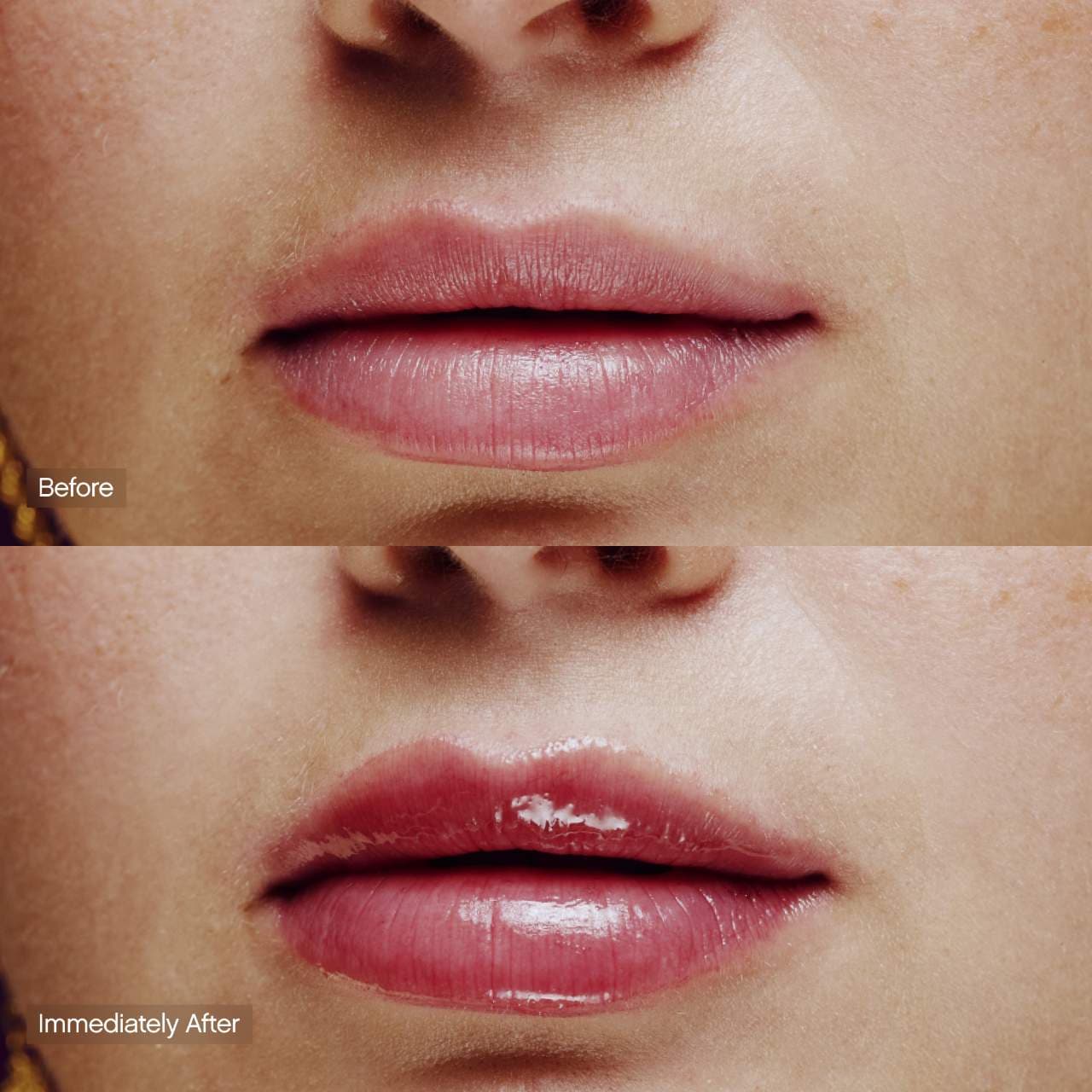 Topicals Slick Salve Lip Balm - Acai