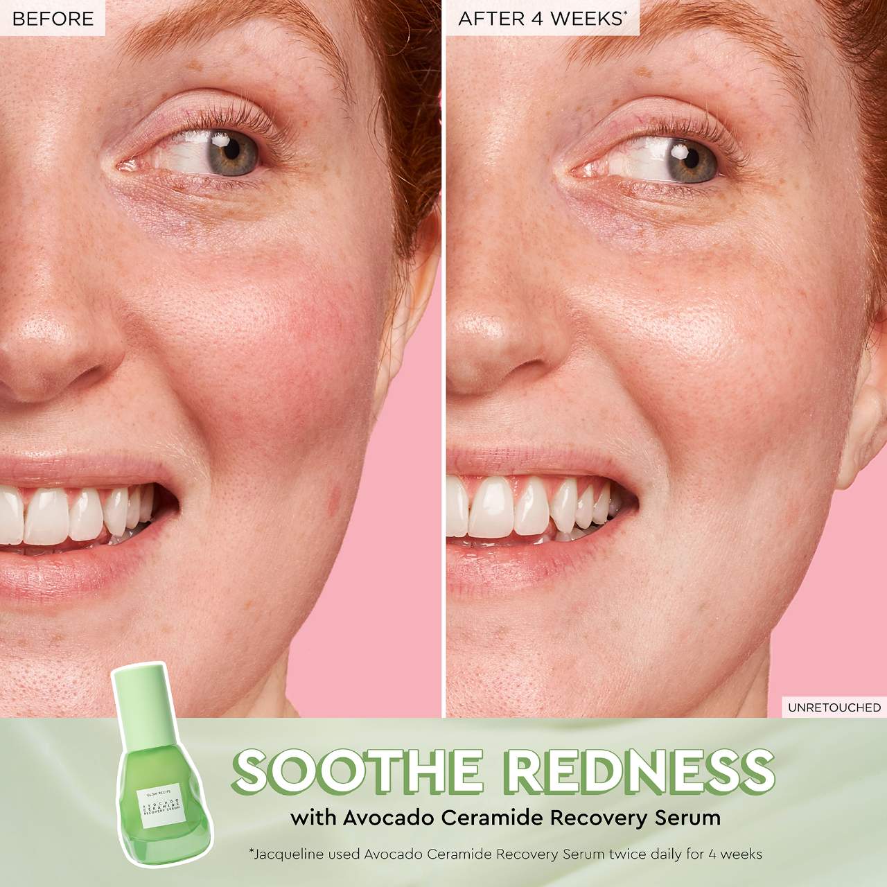 Glow Recipe Fruit Babies Bestsellers Kit Gift Set