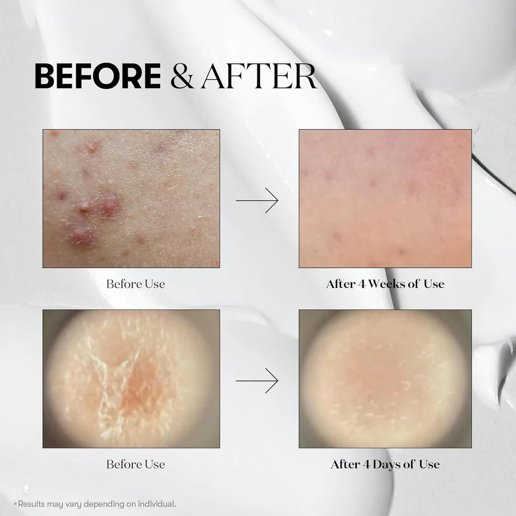 VT Cosmetics Cica Reedle Shot 50