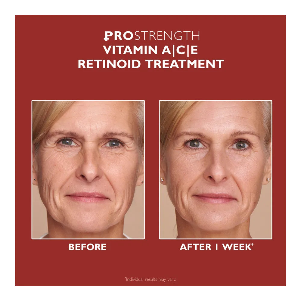 Peter Thomas Roth Pro Strength Vitamin A|C|E Retinoid Treatment