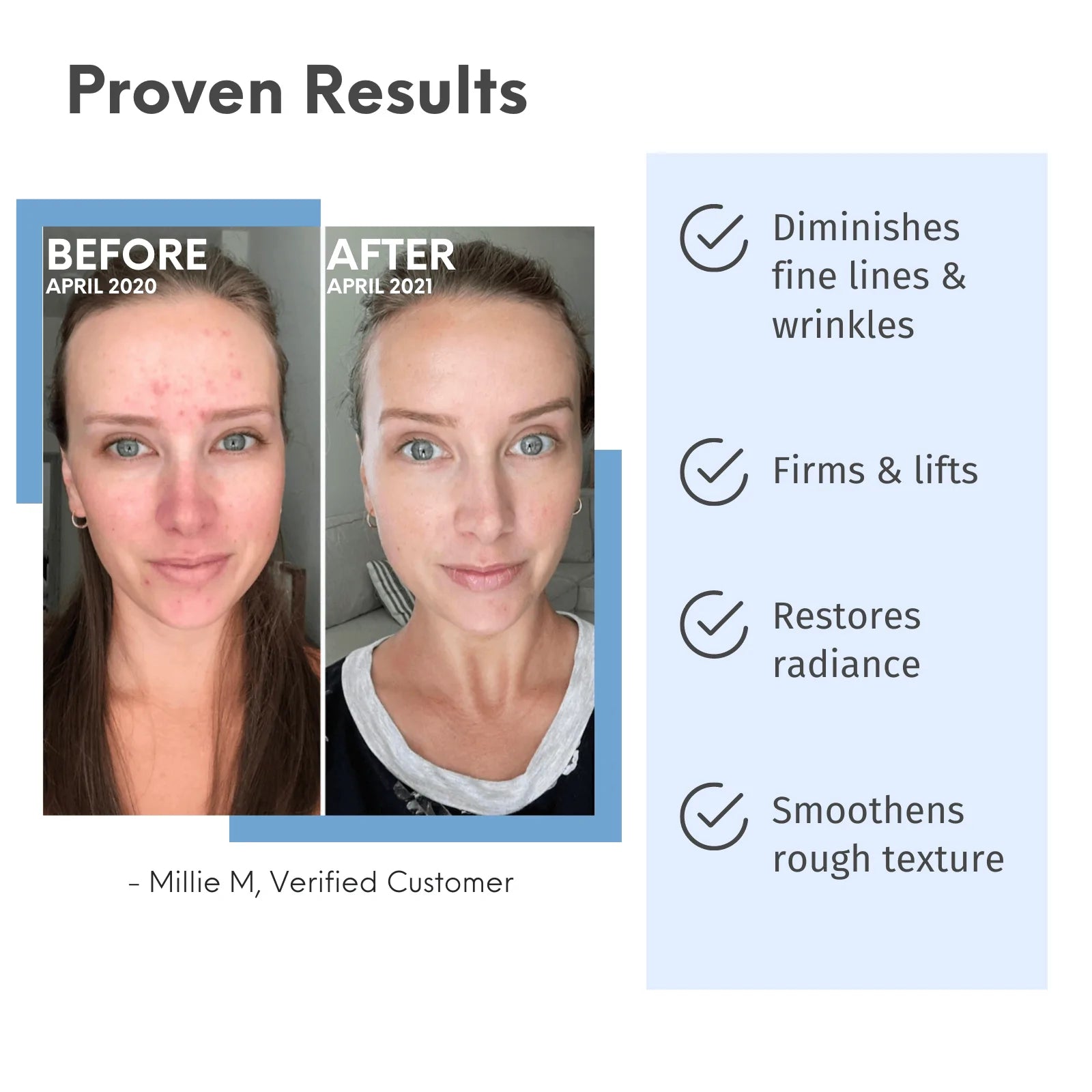 LilyAna Naturals Retinol Cream