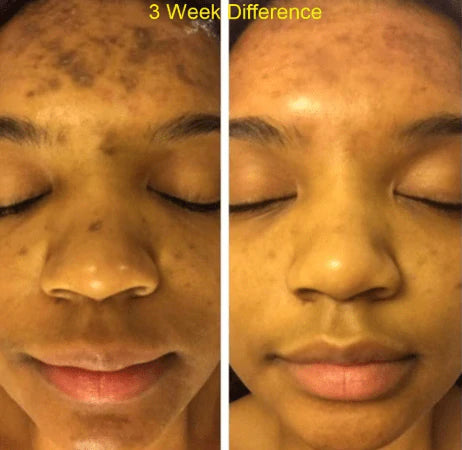 Admire My Skin Ultra Potent Brightening Serum