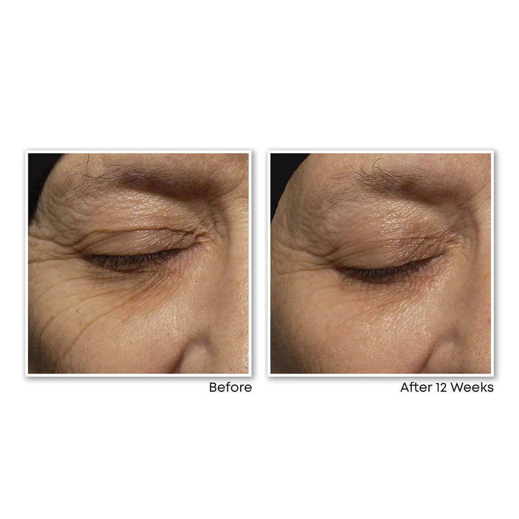 RoC Retinol Correxion® Deep Wrinkle Night Cream