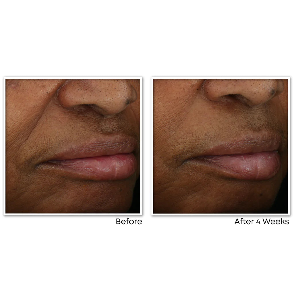 RoC Multi Correxion® Revive + Glow Gel Cream