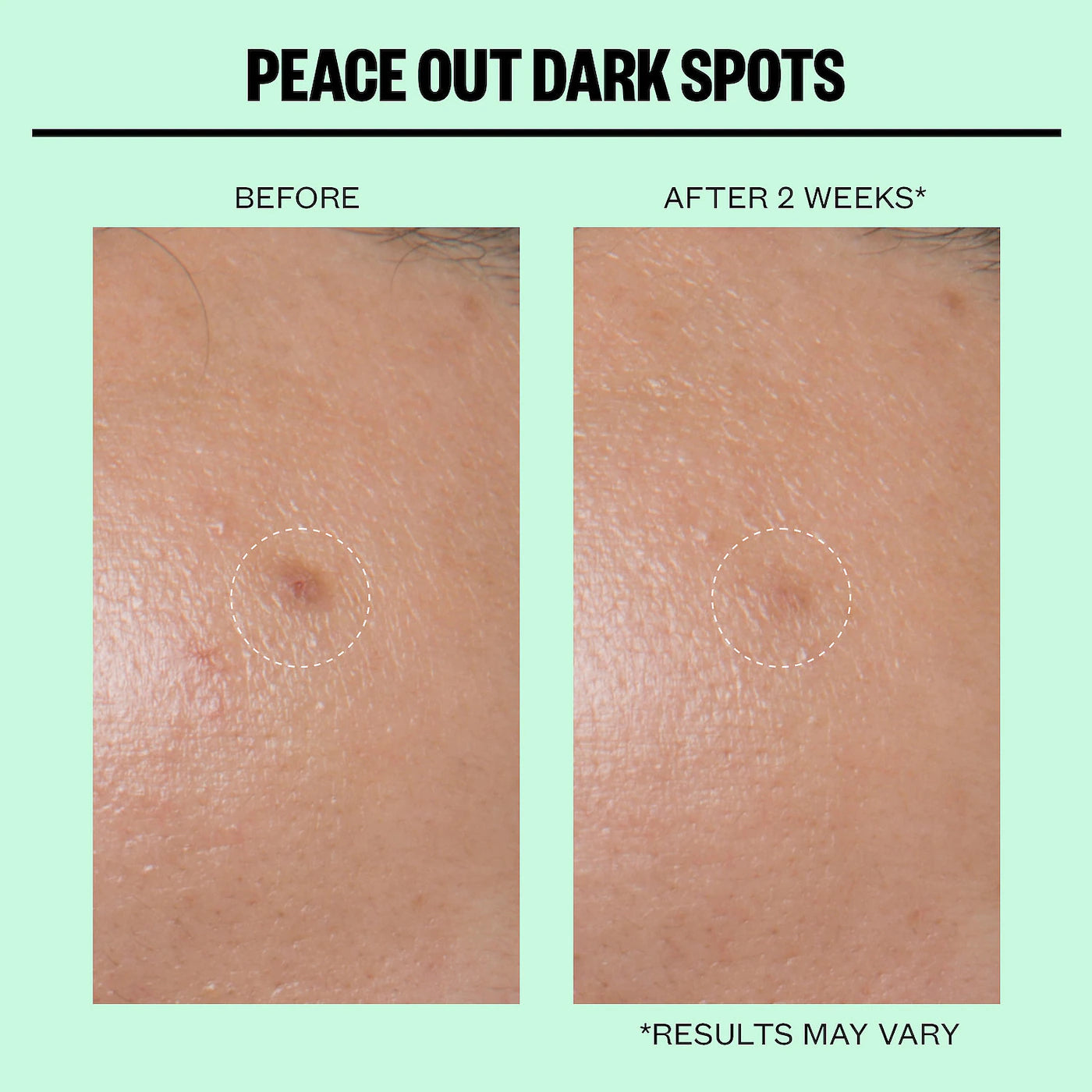 Peace Out Microneedling Dark Spot Brightening Dots