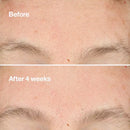 Clinique Clarifying Do-Over Peel