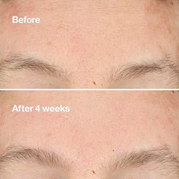 Clinique Clarifying Do-Over Peel