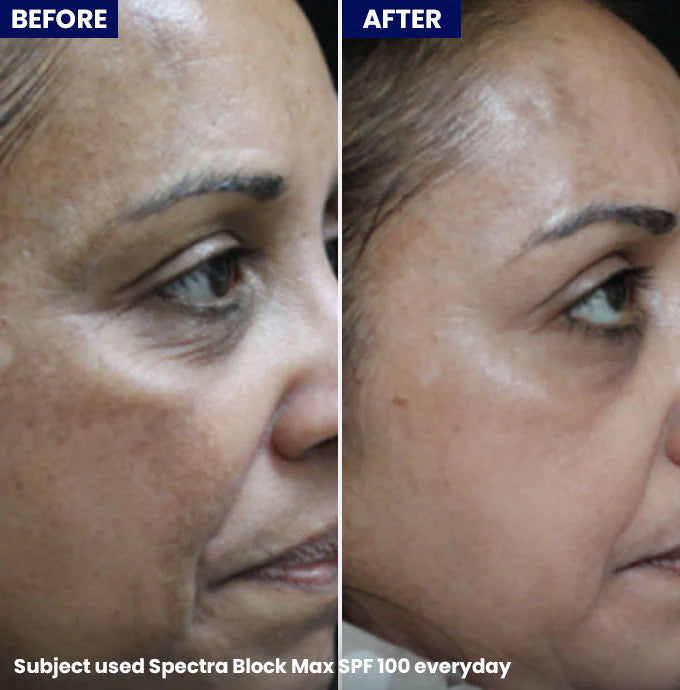 Jenpharm Spectra Block Max SPF 100 PA+++