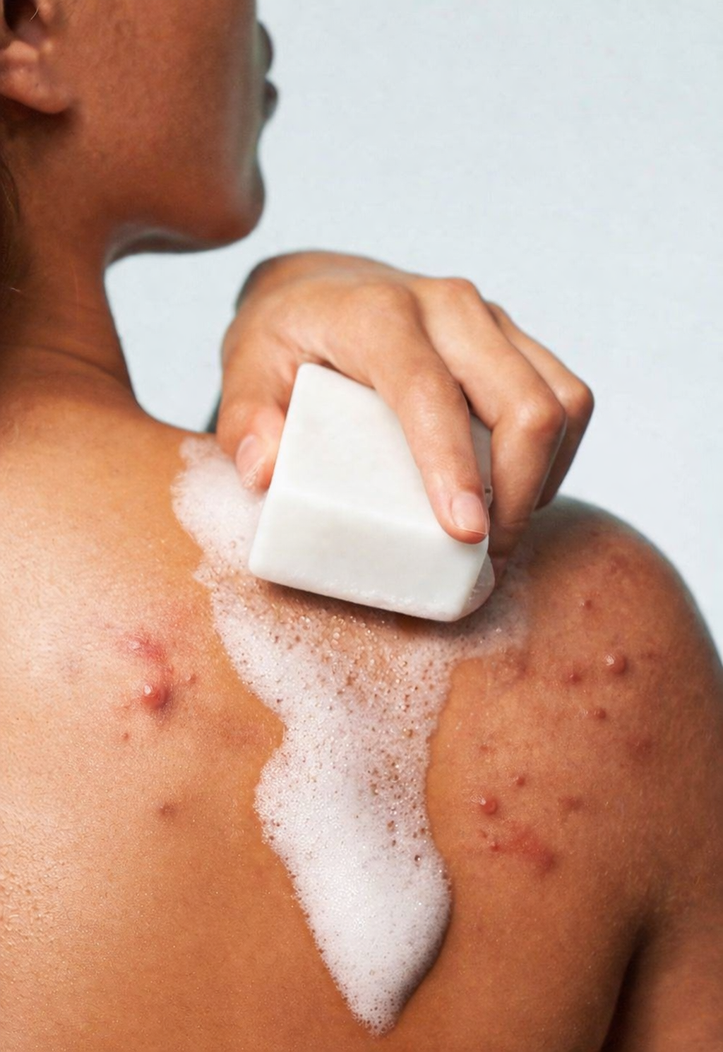 Jenpharm Clarevo Anti Acne Soap