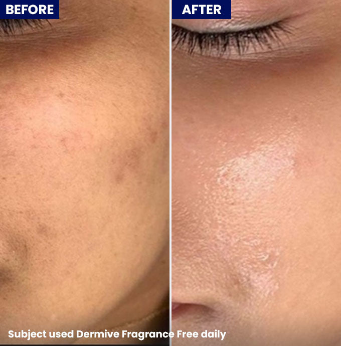 Jenpharm Dermive Oil-Free Moisturizer Fragrance free